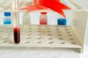Haemophiliacs were given blood products infected with hepatitis and HIV (Alamy/PA)